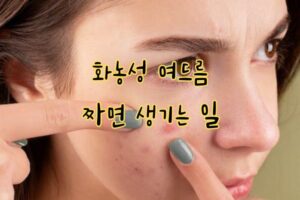 화농성 여드름 관리 방법