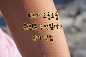 피부 오돌토돌 가려움 원인 피부 오돌토돌 가려움 원인