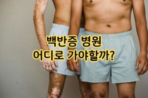 백반증 병원 어디로 가야할까? 백반증 병원 어디로 가야할까?