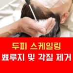 두피 스케일링 뾰루지 및 각질 제거