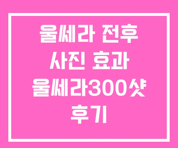 울쎄라 전후 사진 효과 울쎄라300샷 후기