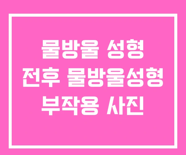 물방울 성형 전후 물방울성형 부작용 사진