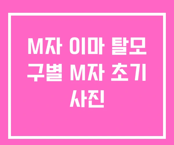 M자 이마 탈모 구별 M자 초기 사진