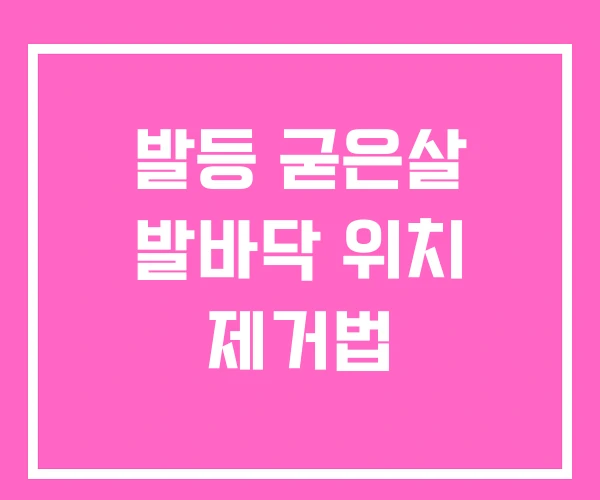 발등 굳은살 발바닥 위치 제거법