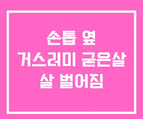 손톱 옆 거스러미 굳은살 살 벌어짐