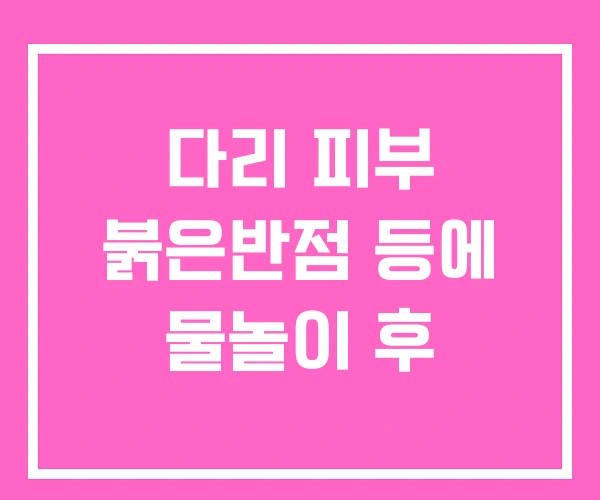 다리 피부 붉은반점 등에 물놀이 후