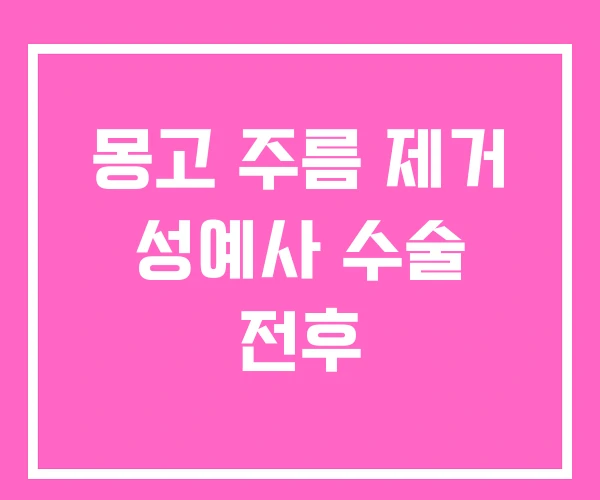 몽고 주름 제거 성예사 수술 전후 몽고 주름 제거 성예사 수술 전후