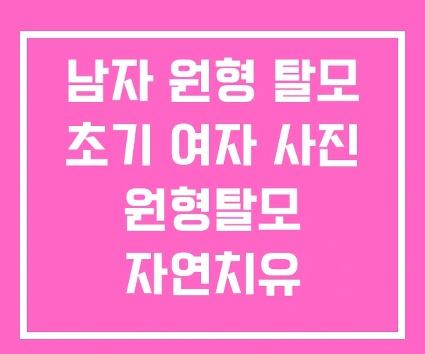 남자 원형 탈모 초기 여자 사진 원형탈모 자연치유 남자 원형 탈모 초기 여자 사진 원형탈모 자연치유