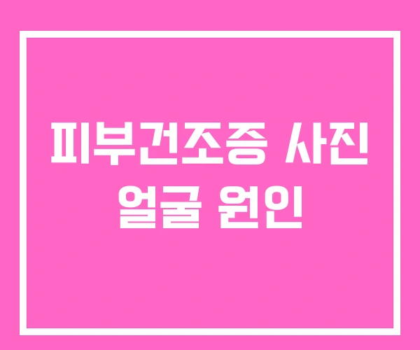 피부건조증 사진 얼굴 원인