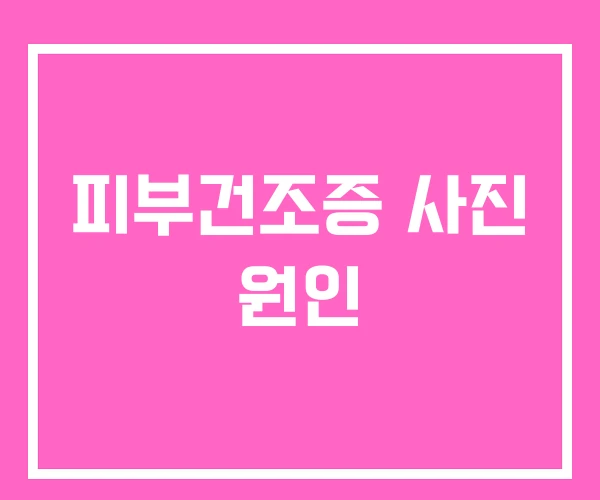 피부건조증 사진 원인 피부건조증 사진 원인